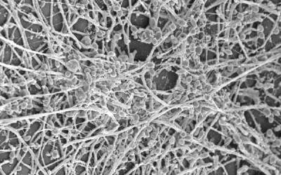 Kandida, gljivica XXI veka