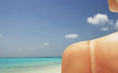 Kako oporaviti kožu posle sunčanja?